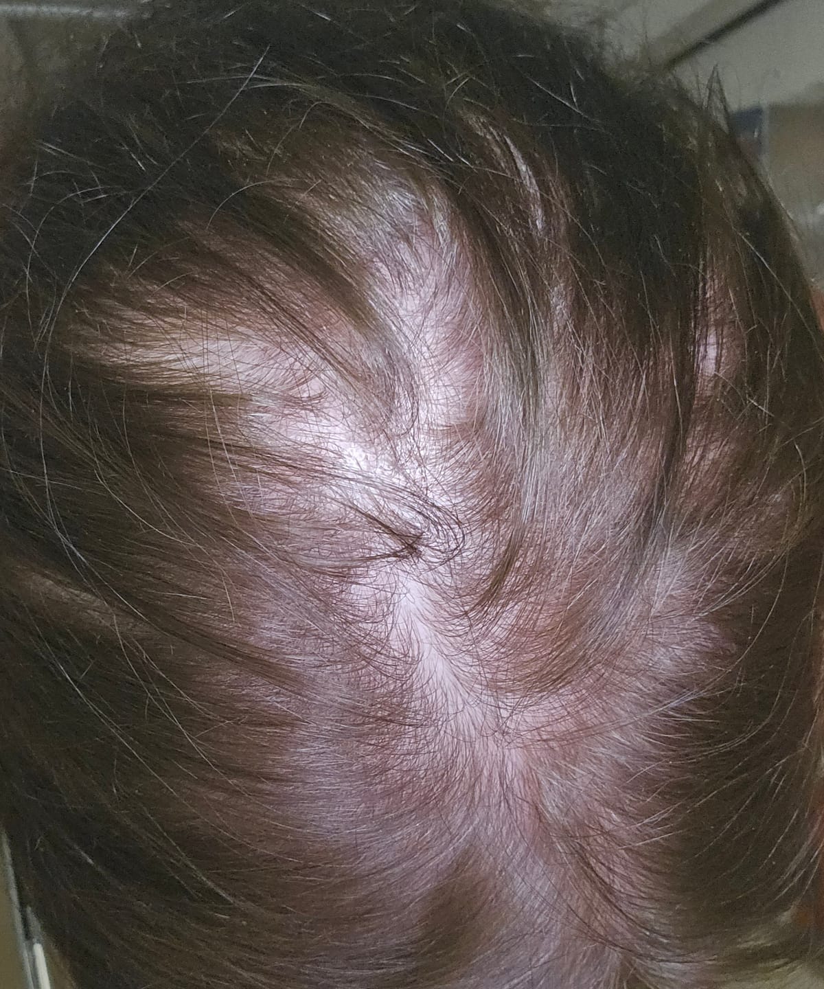 Customer photo review of SHAMPOING NATUREL AU ROMARIN ET À LA KÉRATINE — POUR DES CHEVEUX PLUS ÉPAIS ET PLUS VOLUMINEUX