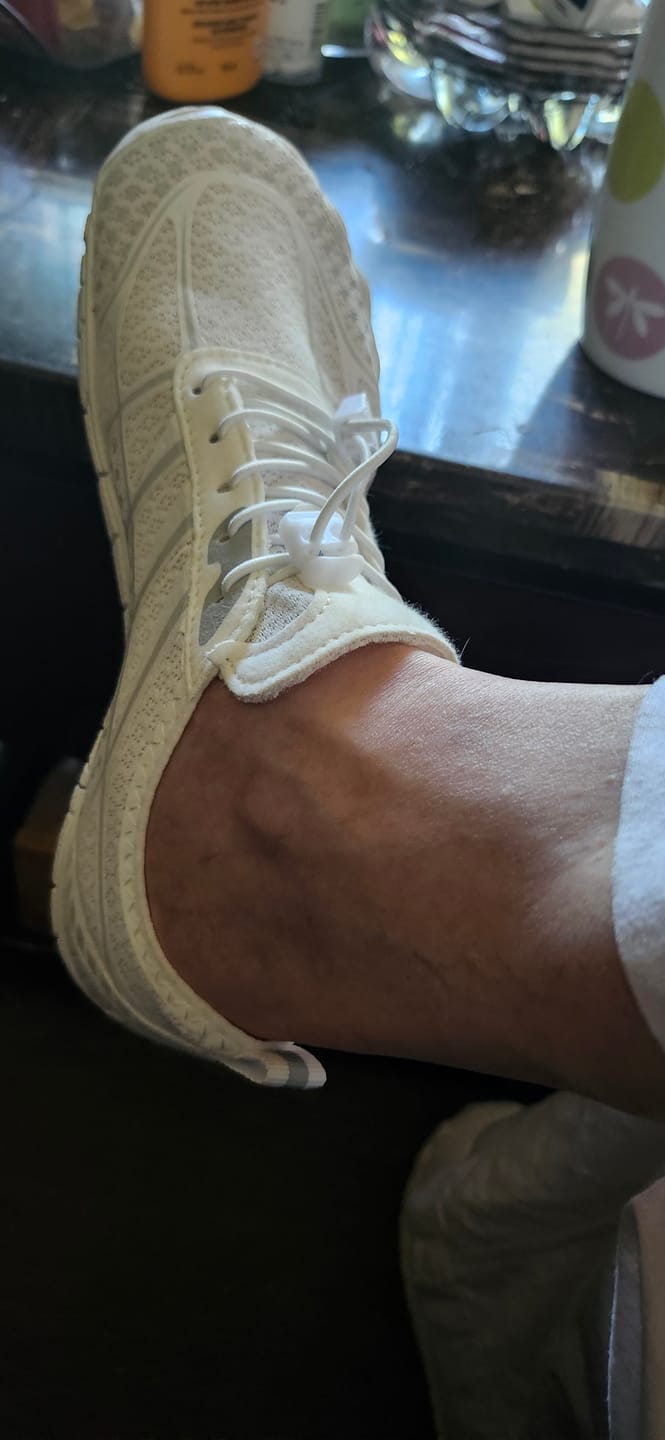Customer photo review of TerraStride-BOGO