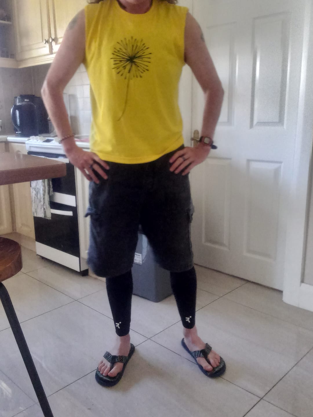 Customer photo review of KniTec V2 - Compression Sleeves For Knees & Legs