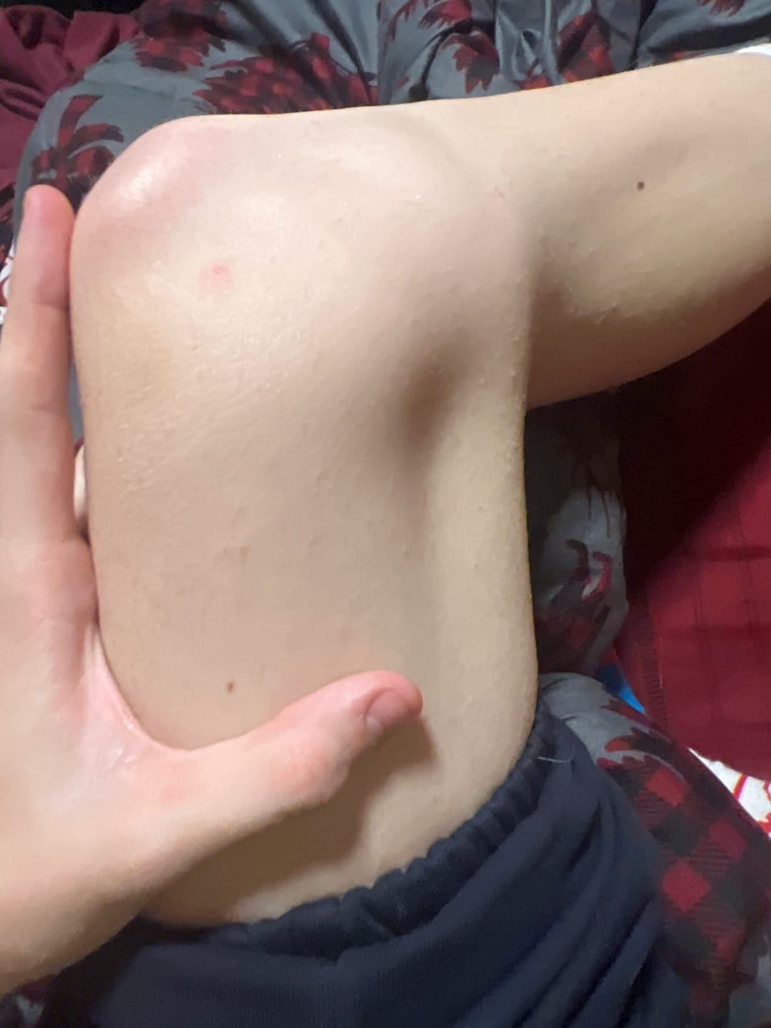 Customer photo review of Bumzzy Butt Shaver 2.0