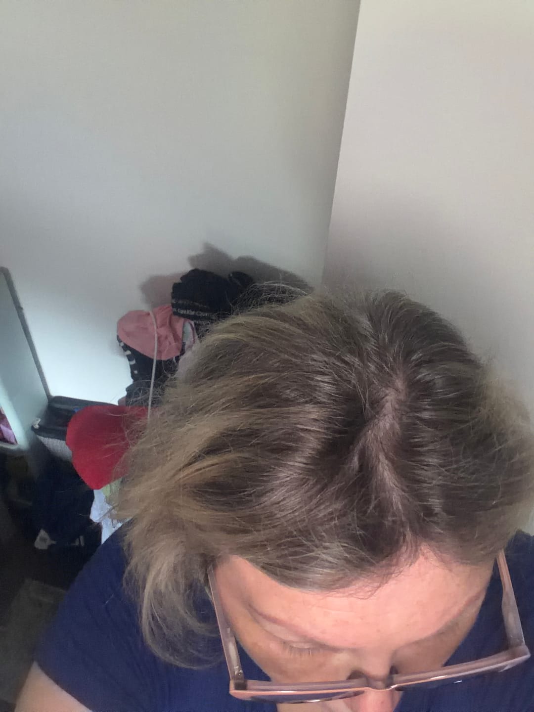 Customer photo review of Giselle Light Volume Hair Topper