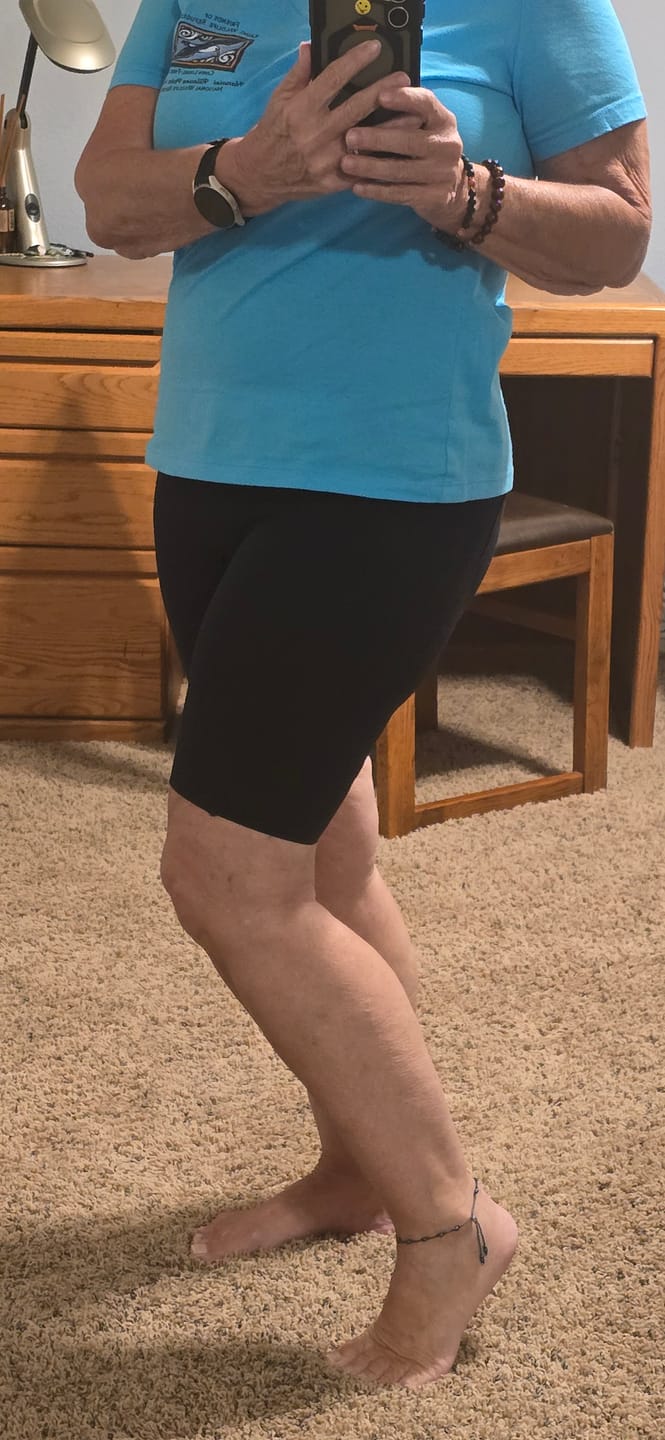 Customer photo review of Silix Pocket 3D Anti-Cellulite Sculpting Leggings