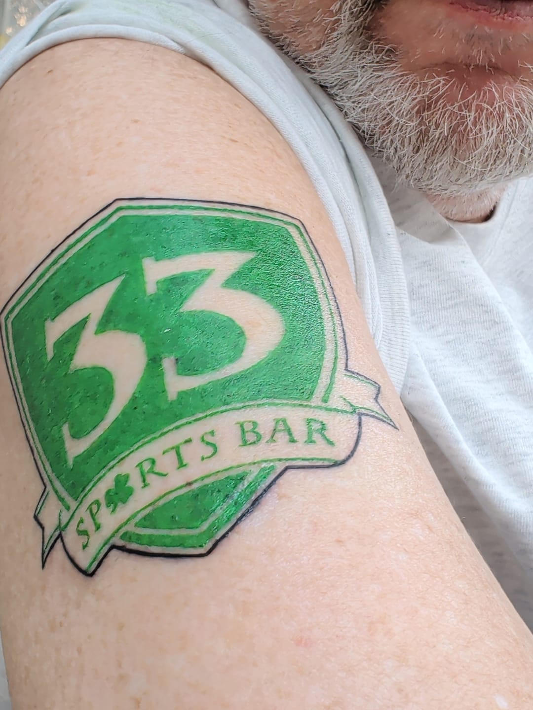 Customer photo review of TattooNumbx Numbing Cream
