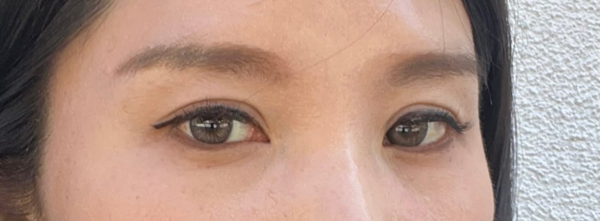 Customer photo review of 1-Day Acuvue Define Fresh Grayzel Color Contact Lenses (30 Pack)