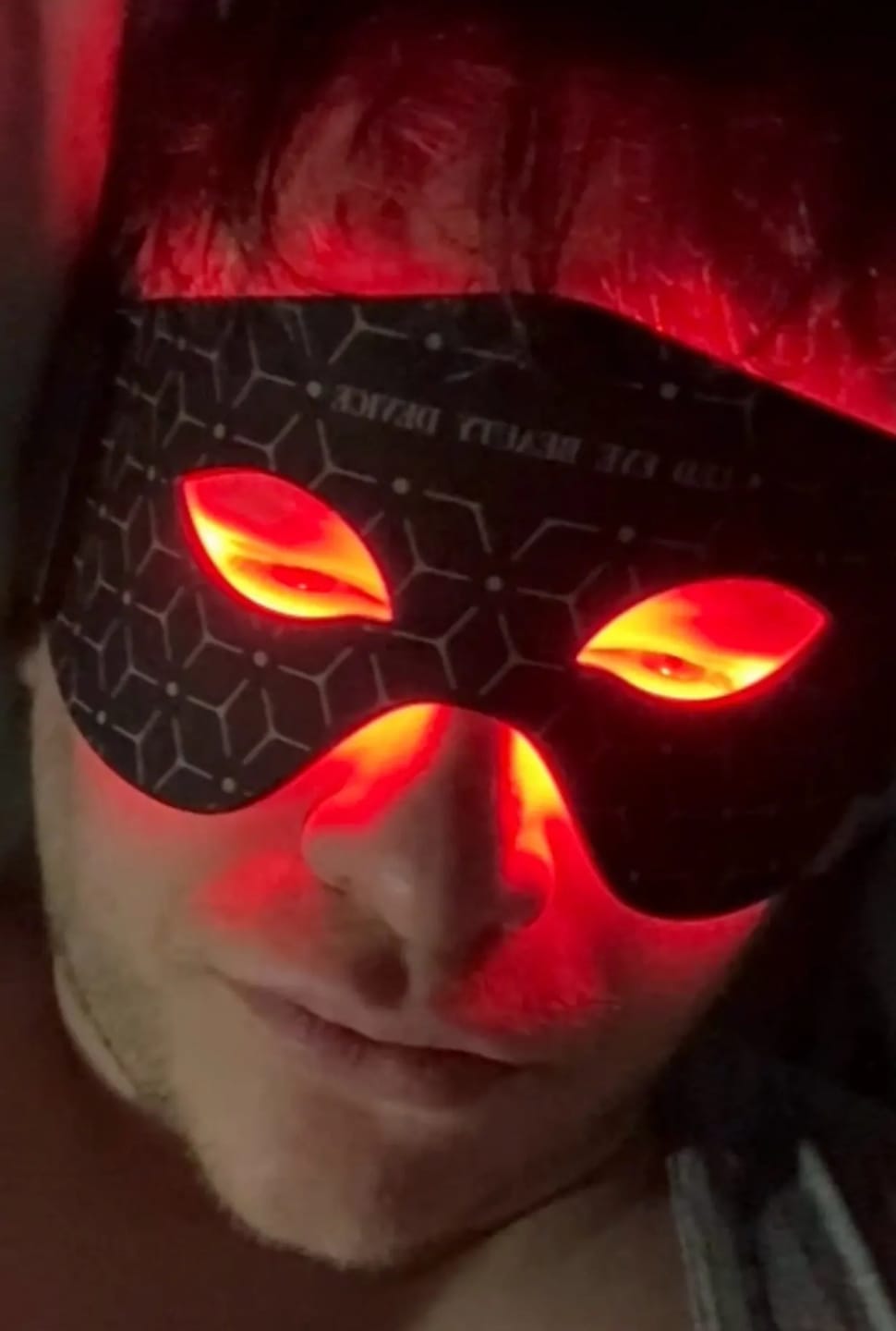 Customer photo review of LED Beauty Eyes Massage Facial Mask Photon Red Light Therapy PDT Phototherapy AU