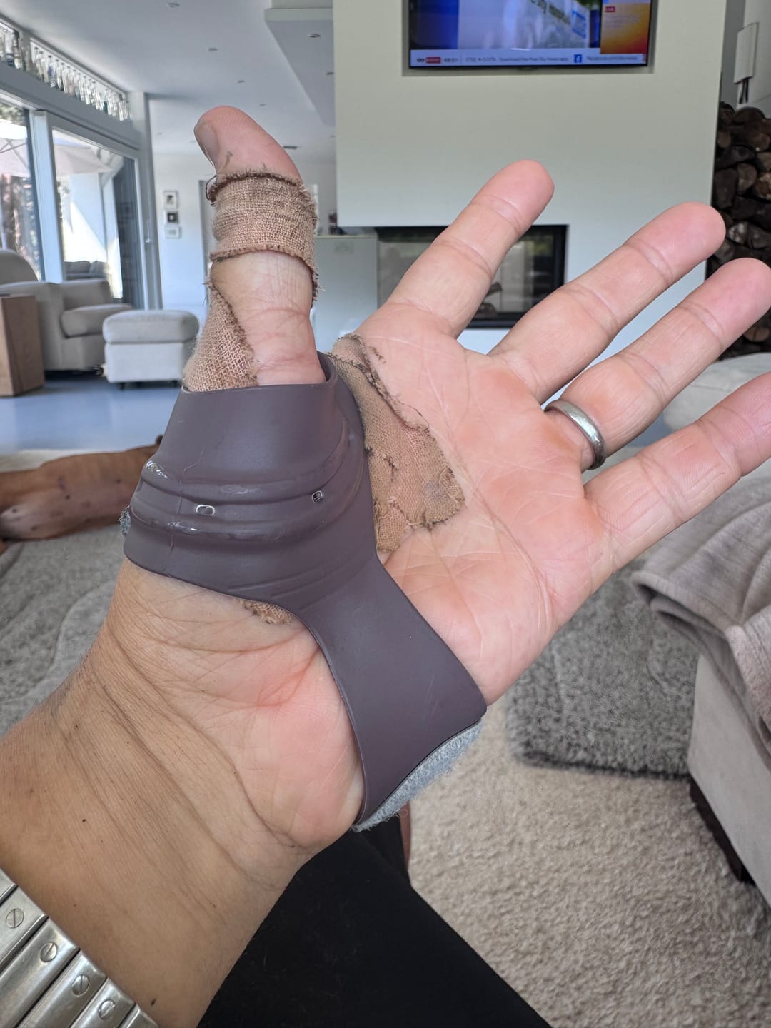 Customer photo review of Push Ortho CMC Thumb Brace – Osteoarthritis Support Splint for Thumb Joint Stabilisation