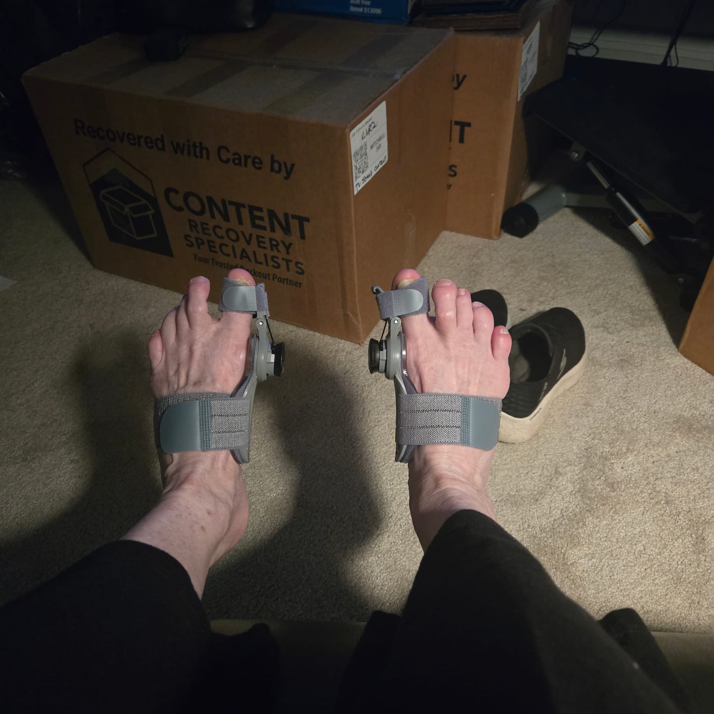 Customer photo review of Treatmedy™ Bunion Fix