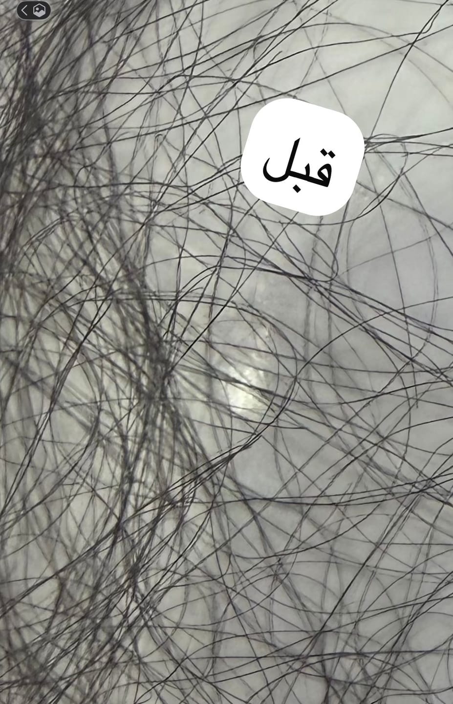 Customer photo review of مجموعة الشعر: تكثيف + نعومة + ترطيب + علاج التساقط