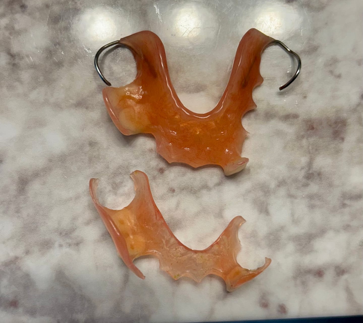 Customer photo review of Flexible Partial Denture