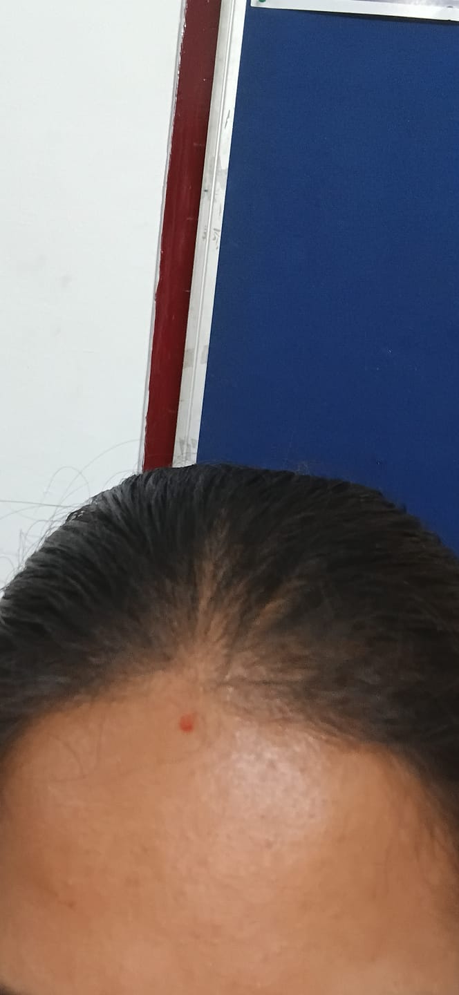 Customer photo review of Advance Hair Growth Serum 2.0 (30ml)