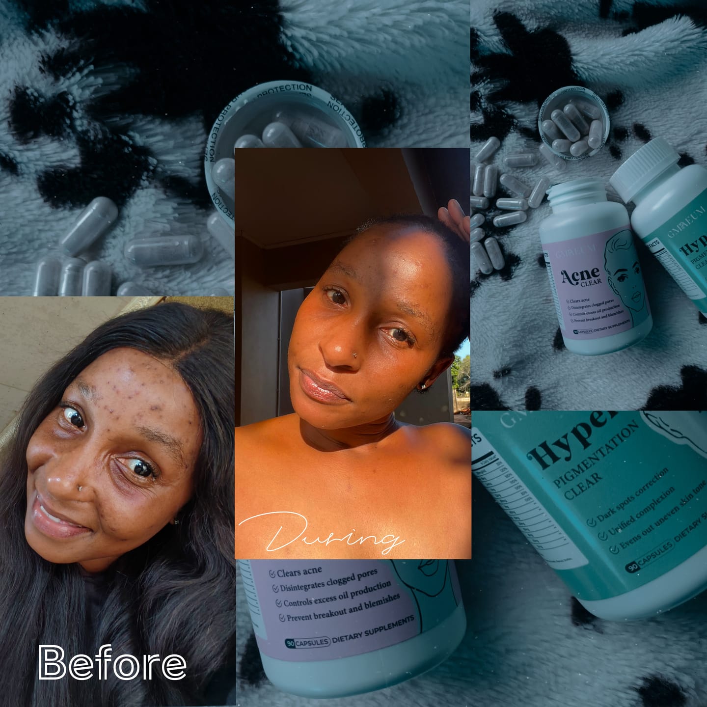 Customer photo review of Gmaeum Clear Complexion Set