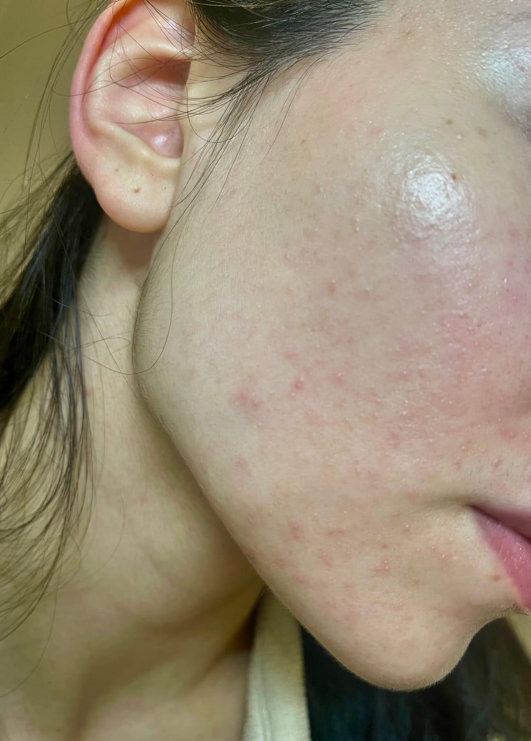 Customer photo review of Soothe & Repair Moisturizer