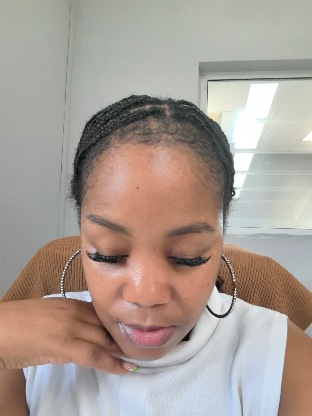 Customer photo review of Minoxidil High Strength (5%) SOLUTION, 3x60ml pack