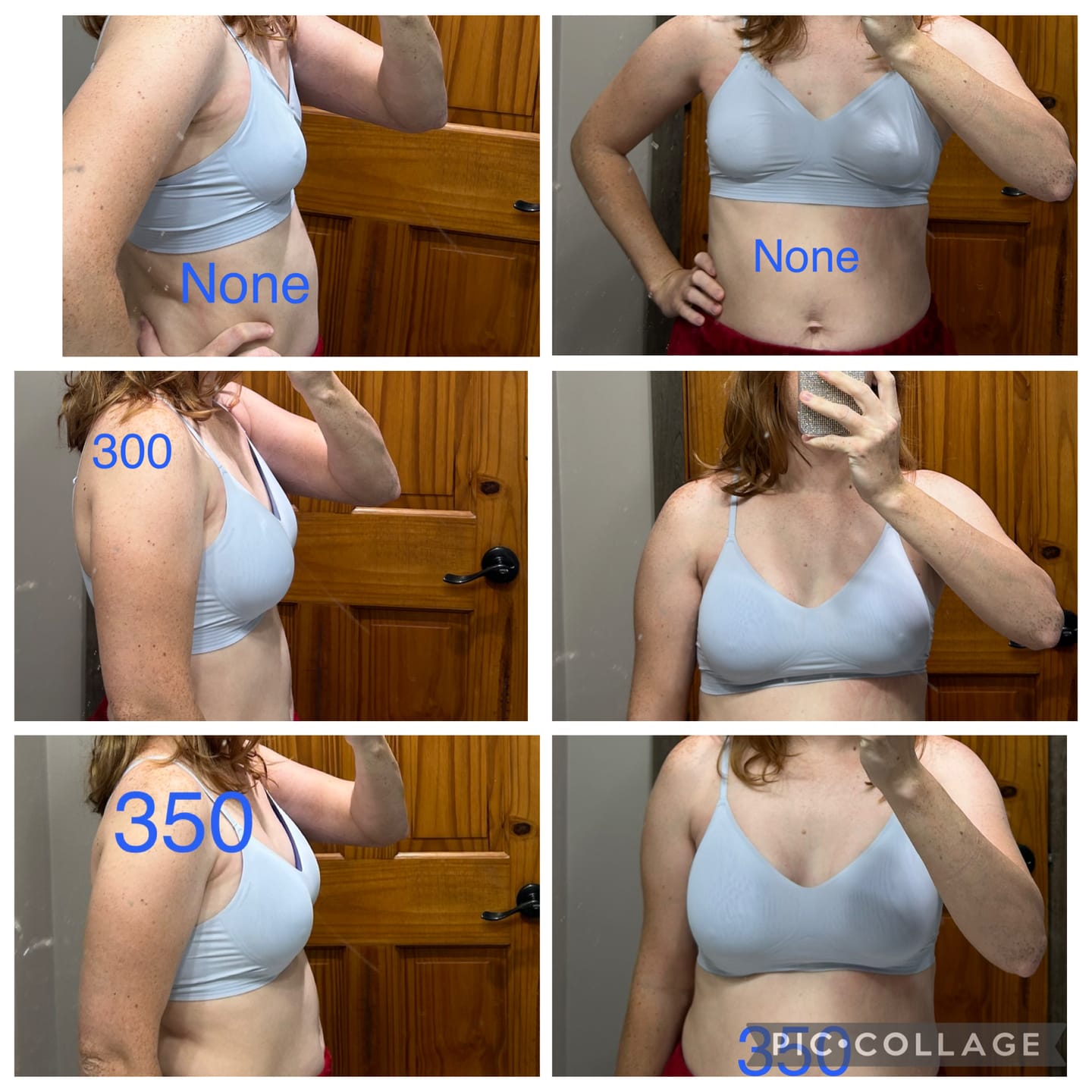 Customer photo review of Breast Implant Sizers Kit