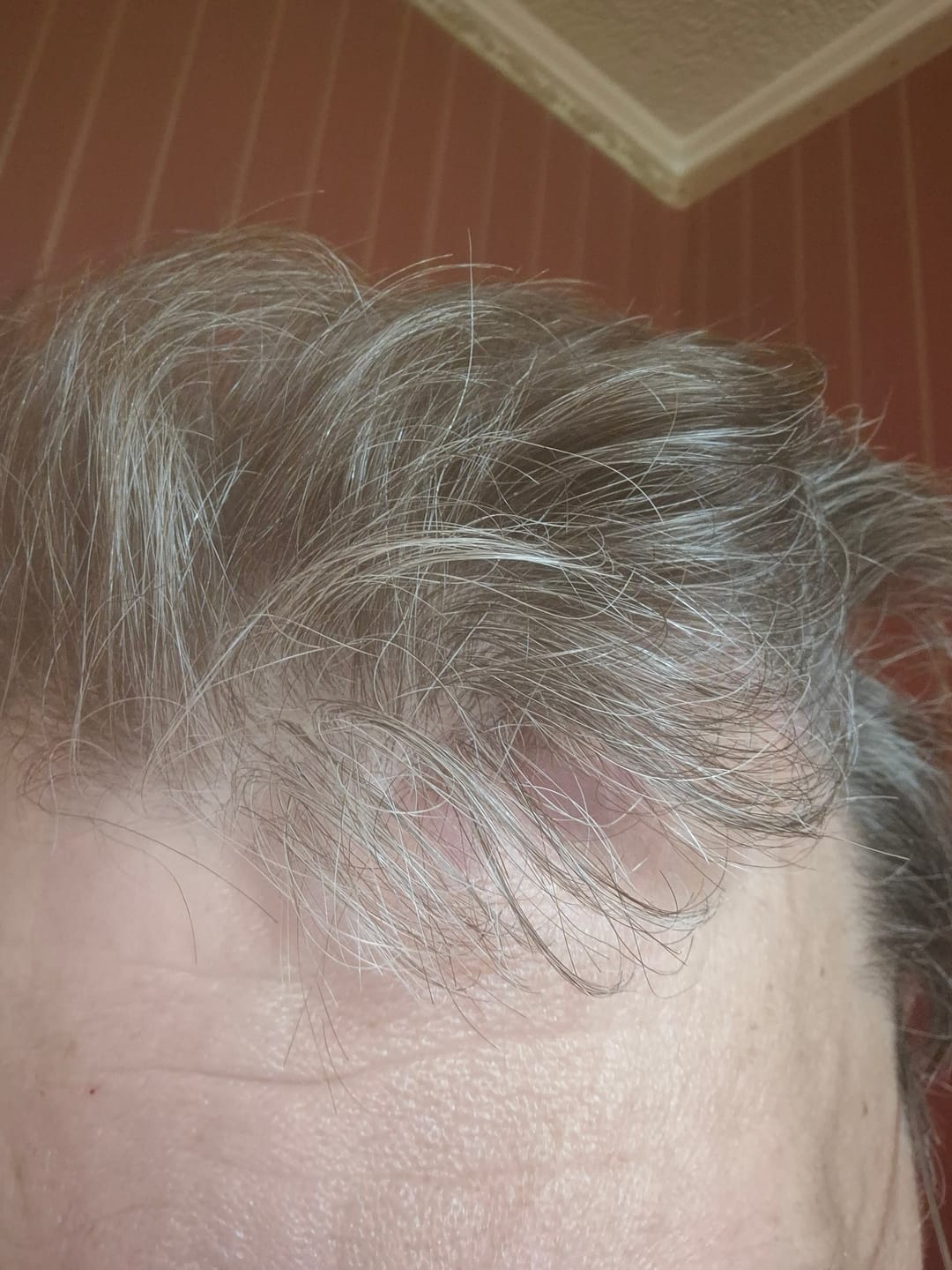 Customer photo review of Sebovia Essence Seborrhea Dermatitis Sampon érzékeny bőrre