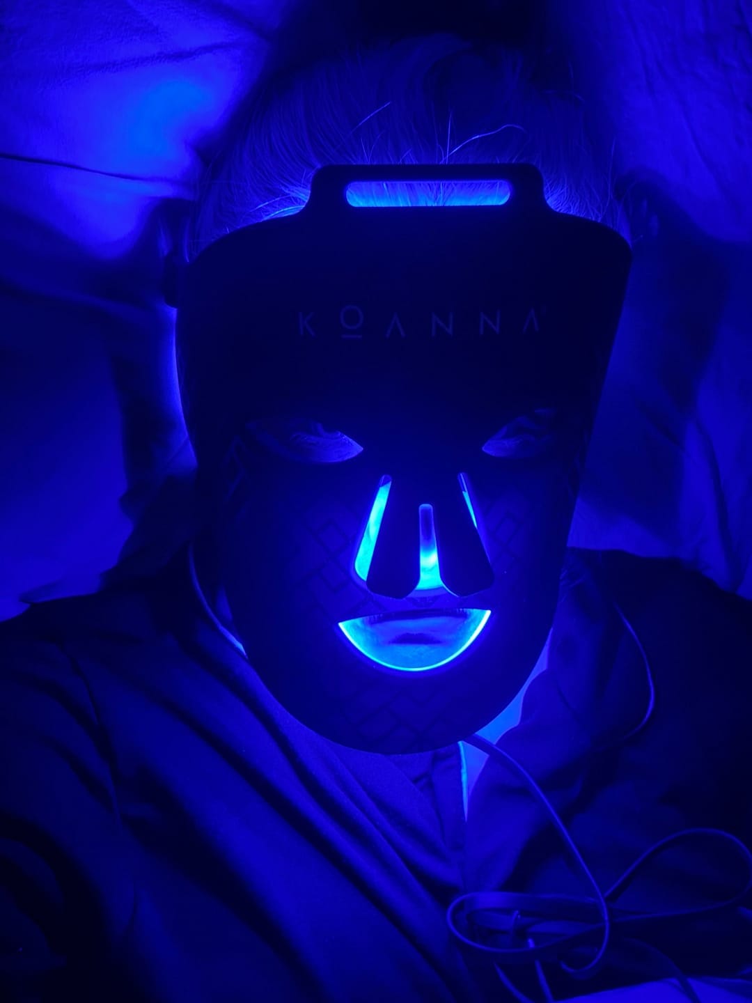 Customer photo review of Koanna® MultiGlo™ LED Light Therapy Mask