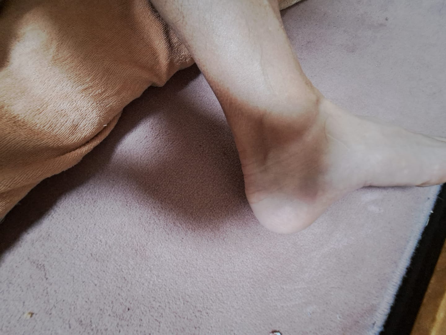 Customer photo review of アシトレマジックカーボン