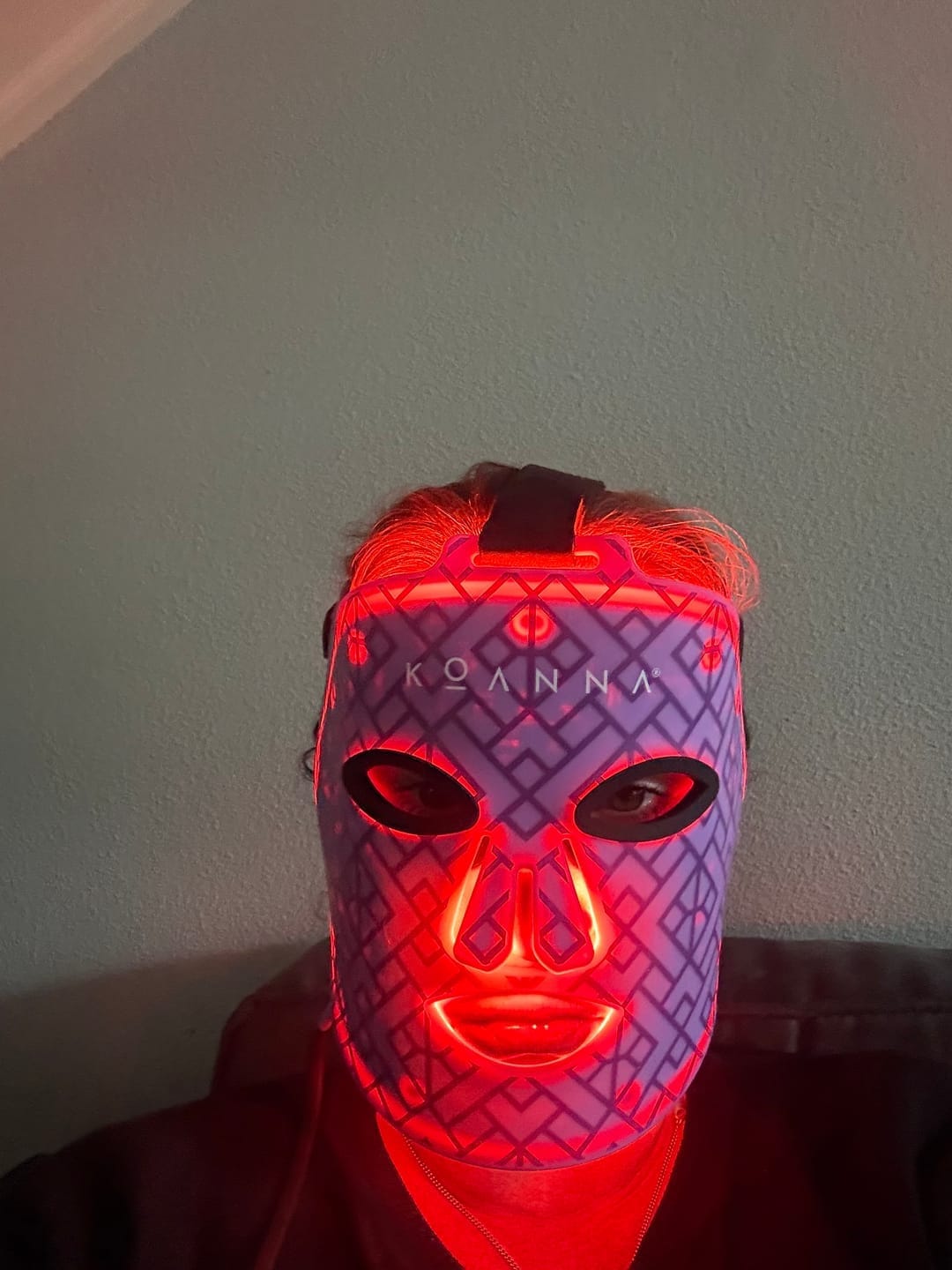 Customer photo review of Koanna® MultiGlo™ LED Light Therapy Mask