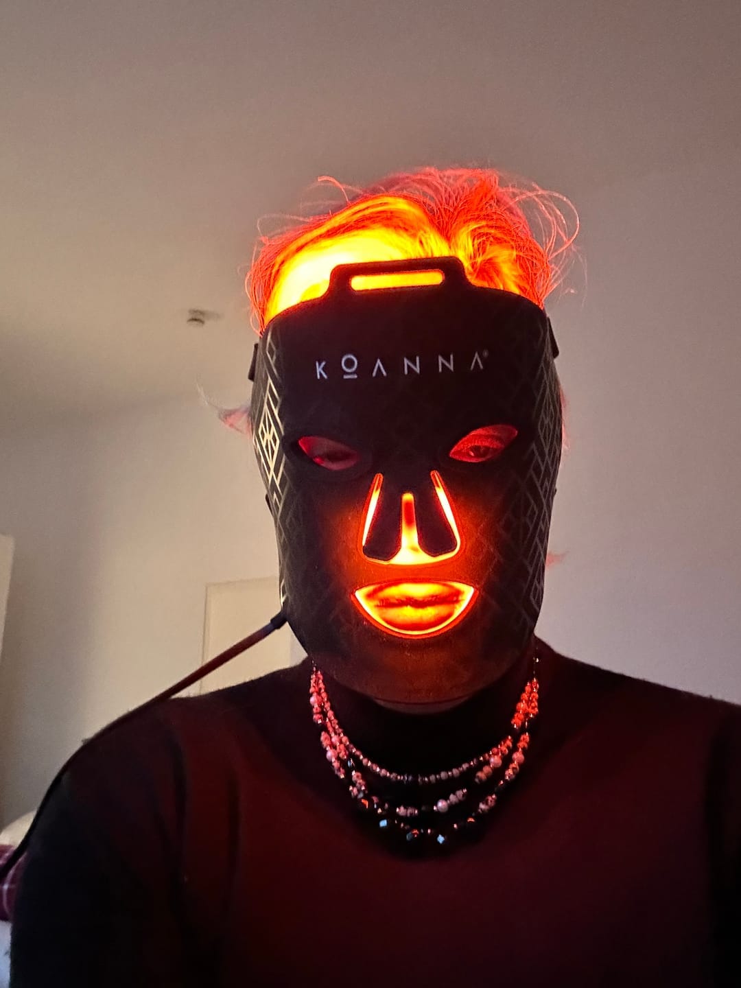 Customer photo review of Koanna® MultiGlo™ LED Light Therapy Mask