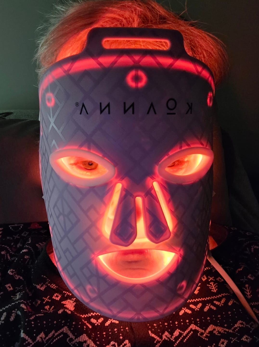 Customer photo review of Koanna® MultiGlo™ LED Light Therapy Mask