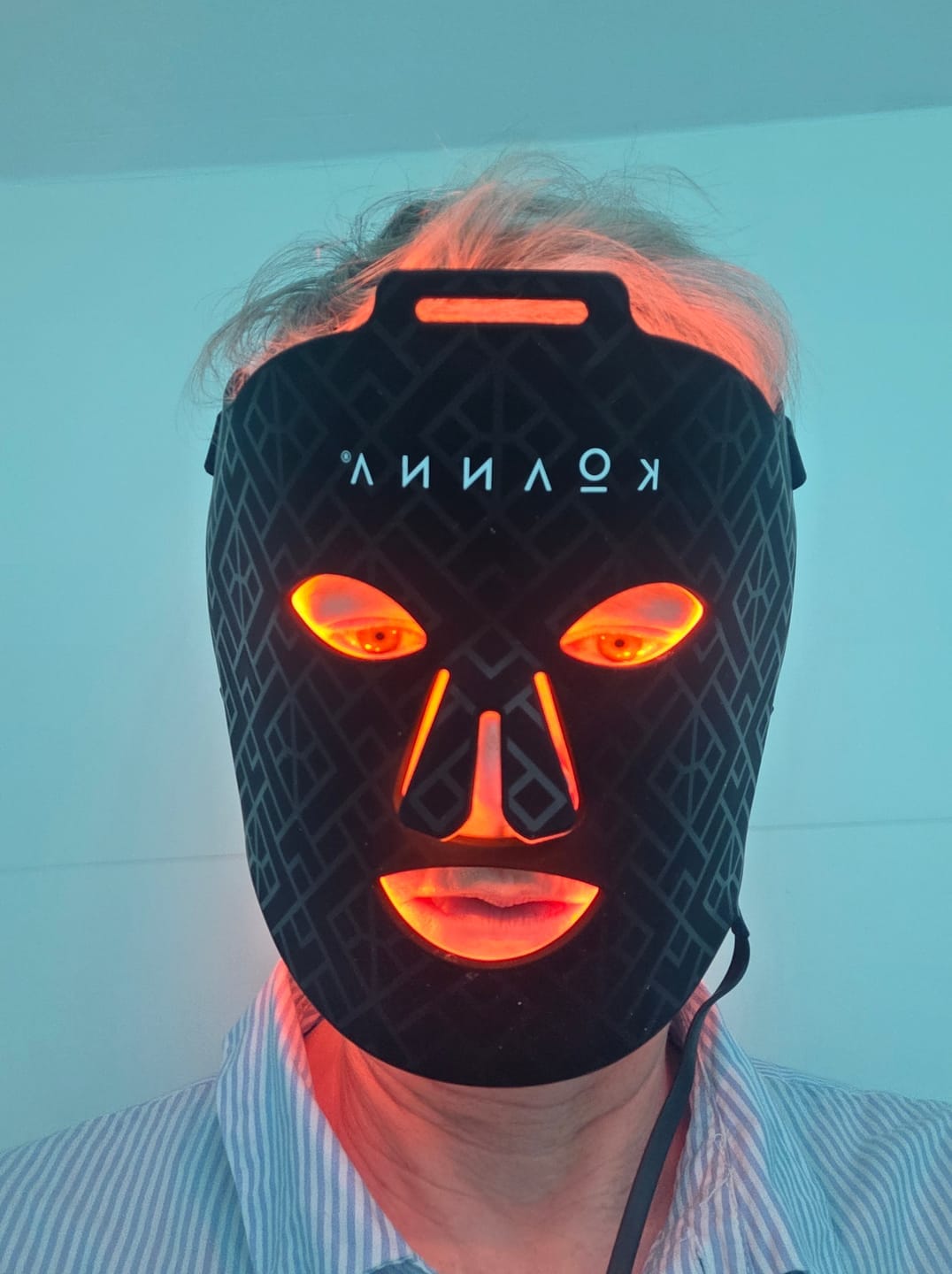 Customer photo review of Koanna® MultiGlo™ LED Light Therapy Mask