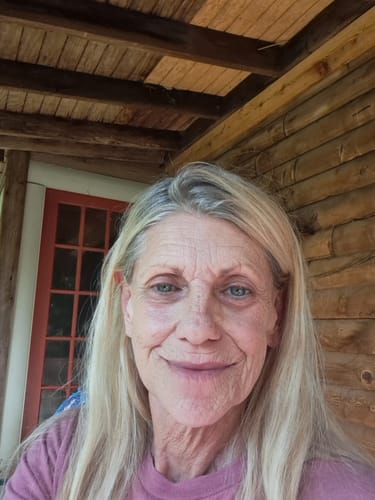 Reviewer's close-up photo showing her smiling face and skin after using the Koriderm™ cream.