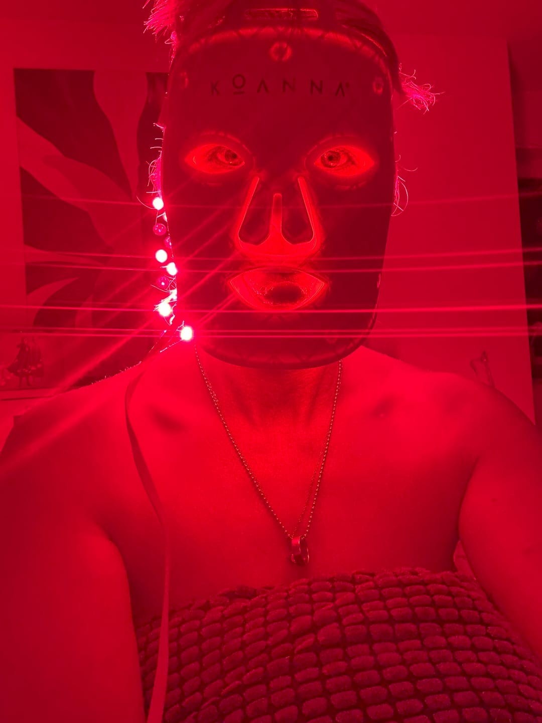 Customer photo review of Koanna® MultiGlo™ LED Light Therapy Mask