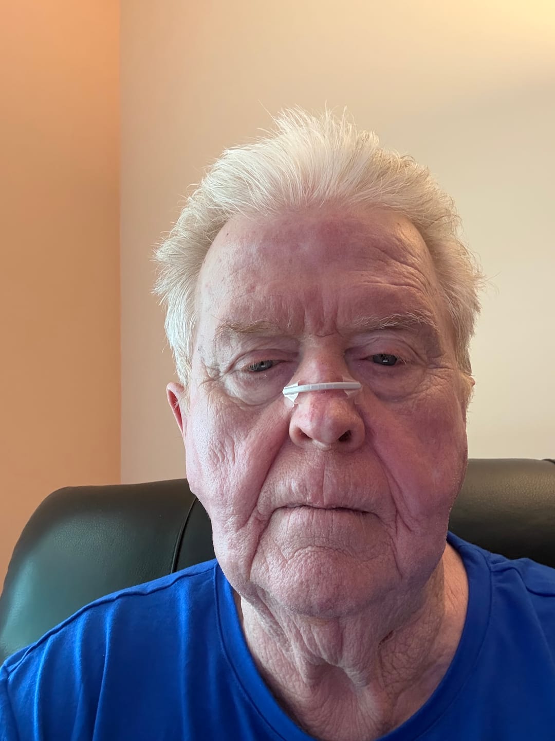 Customer photo review of Second Wind Nasal Strips