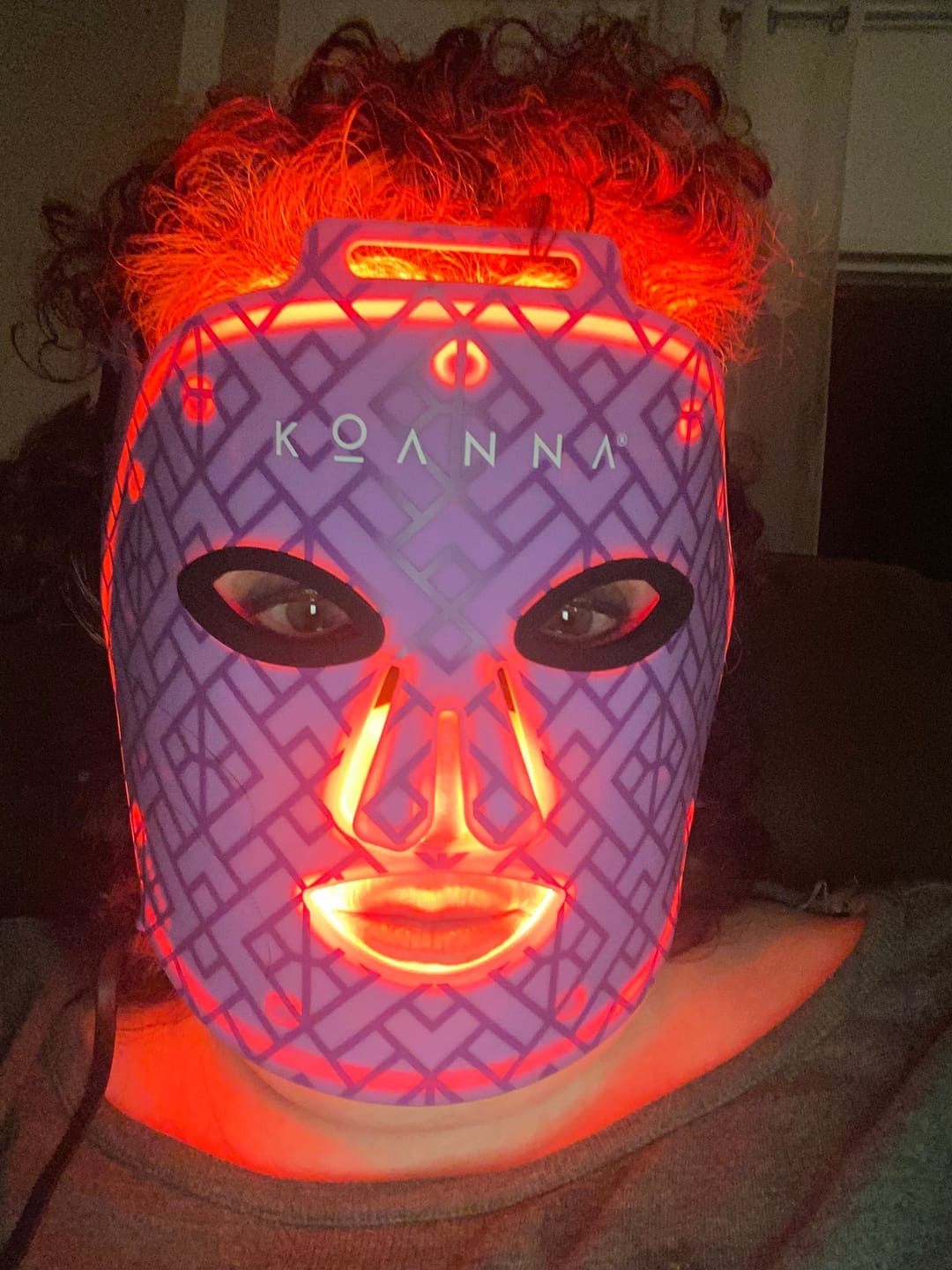 Customer photo review of Koanna® MultiGlo™ LED Light Therapy Mask