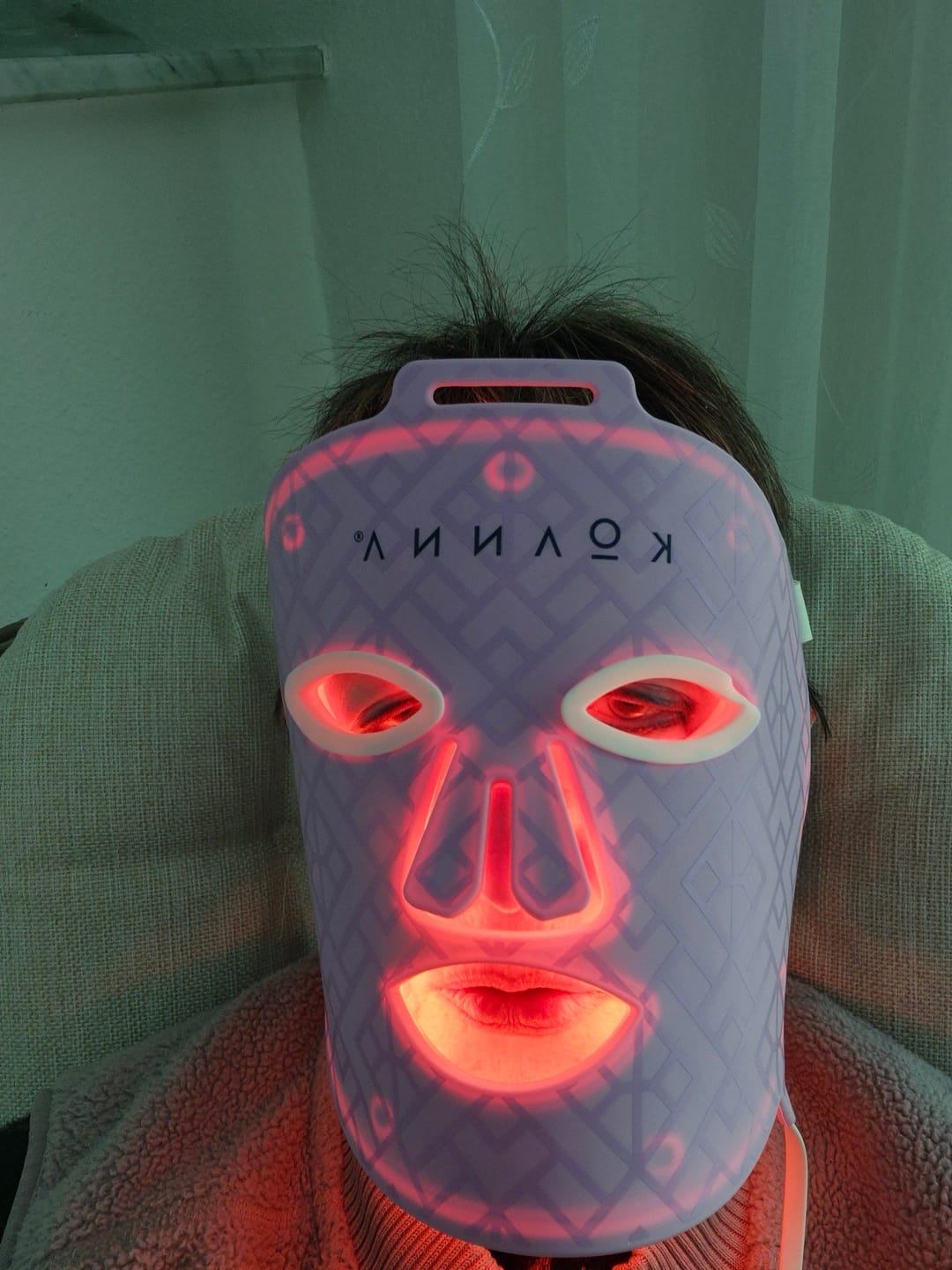 Customer photo review of Koanna® MultiGlo™ LED Light Therapy Mask