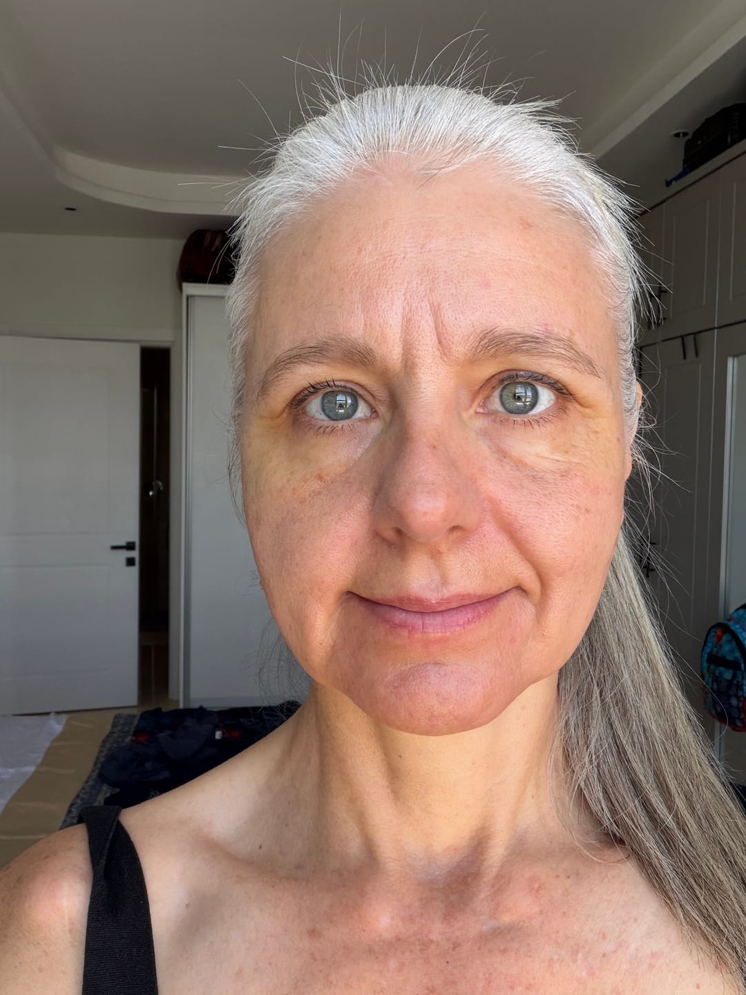 Customer photo review of Natural Skincare Set