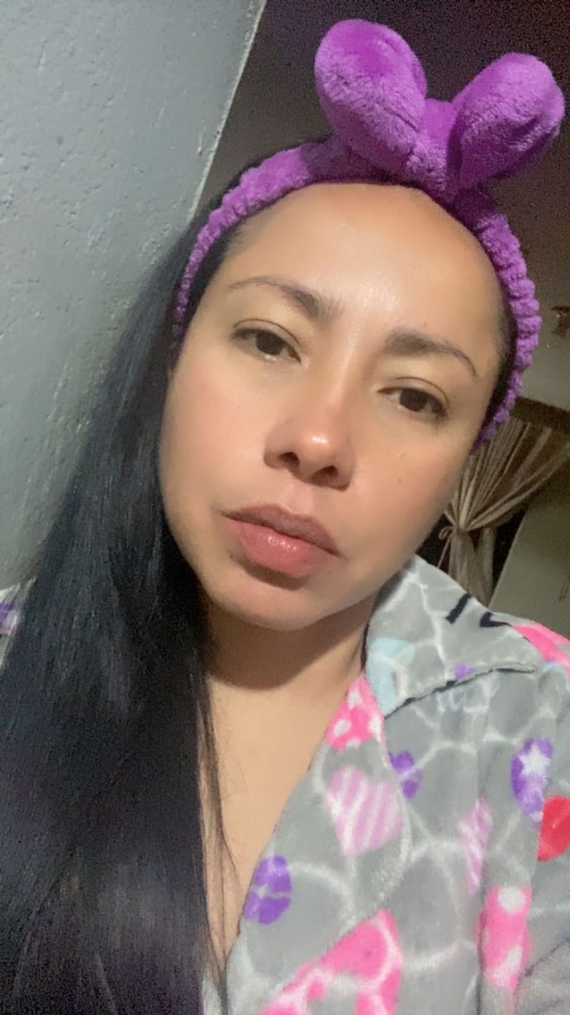 Customer photo review of Hidratante facial de noche con Ceramidas