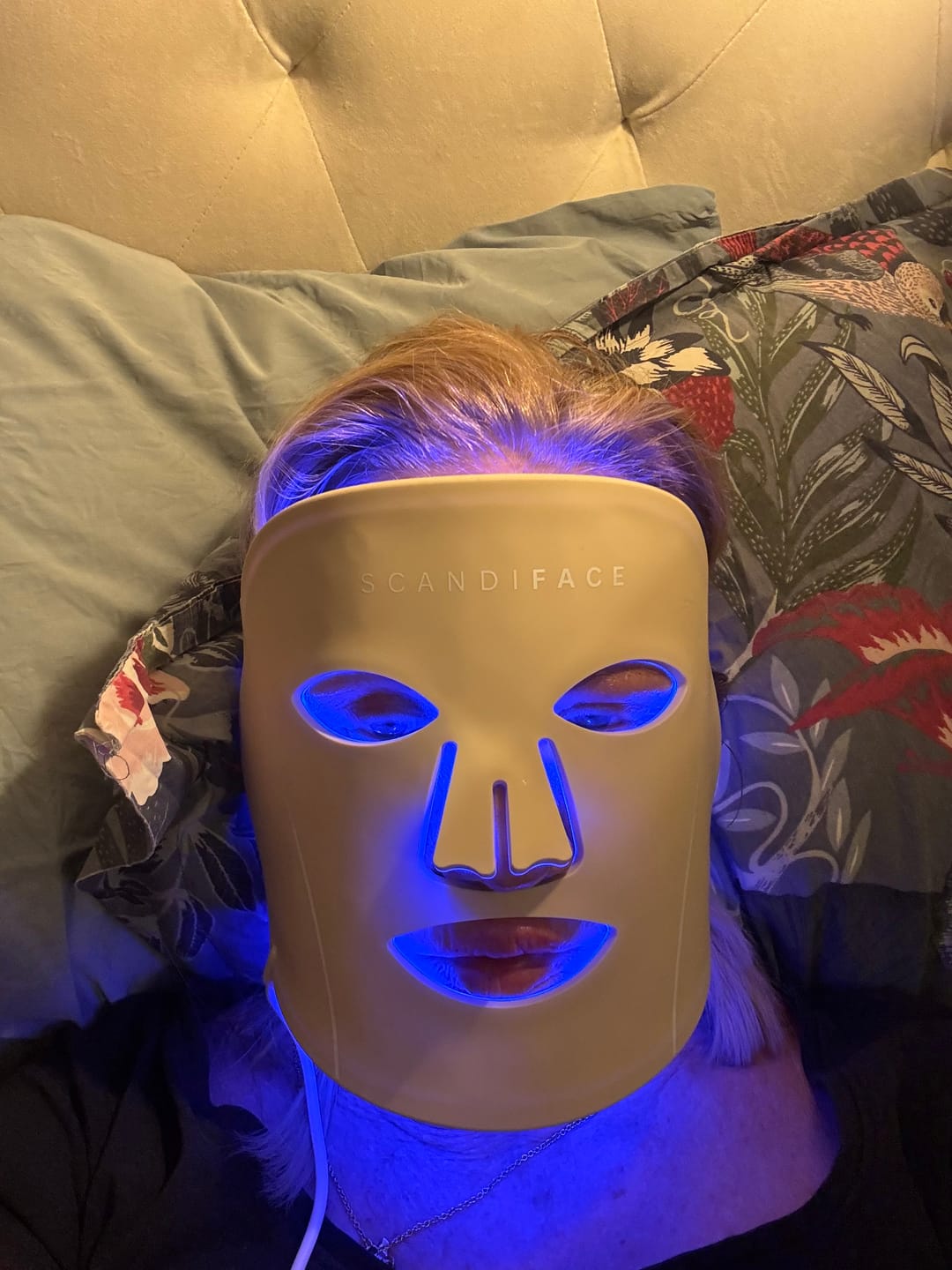 Customer photo review of Skinboosting LED mask
