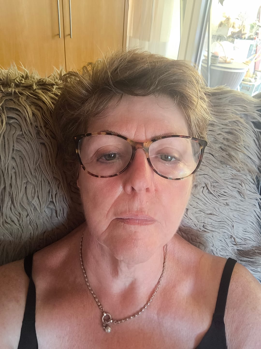 Customer photo review of Natural Botulin Serum