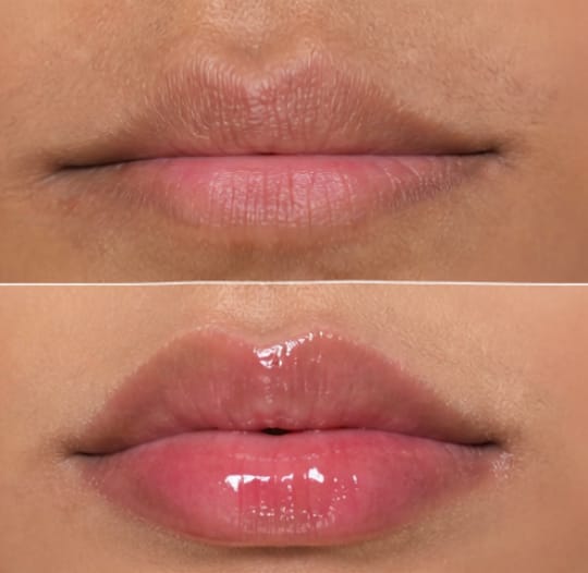 Customer photo review of Collagen Lip Plumper | 100% Natural & Vegan