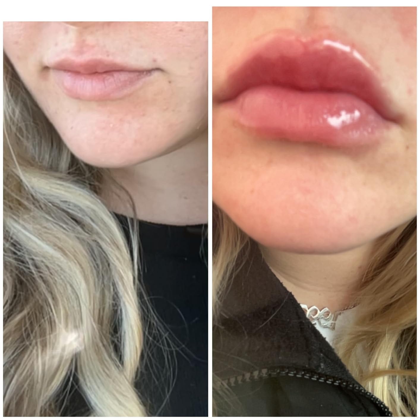 Customer photo review of Dr. Melaxin Lip Shot – гланц за устни с plump ефект