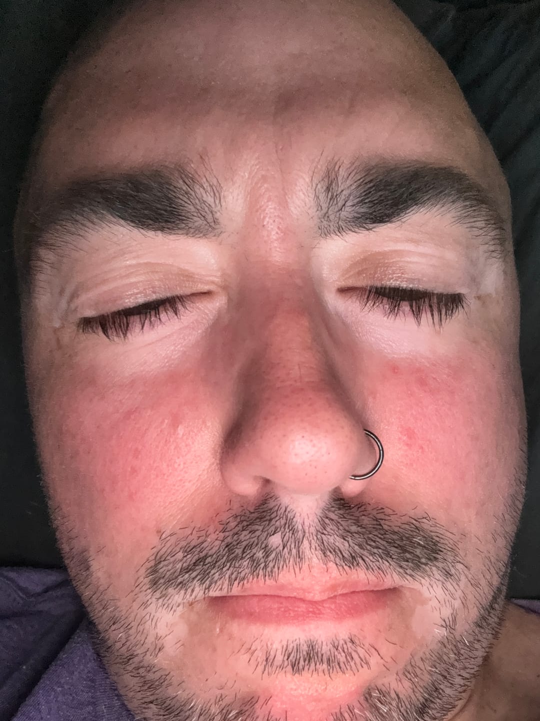 Customer photo review of Lychee Dragon (10mg) Value Pack