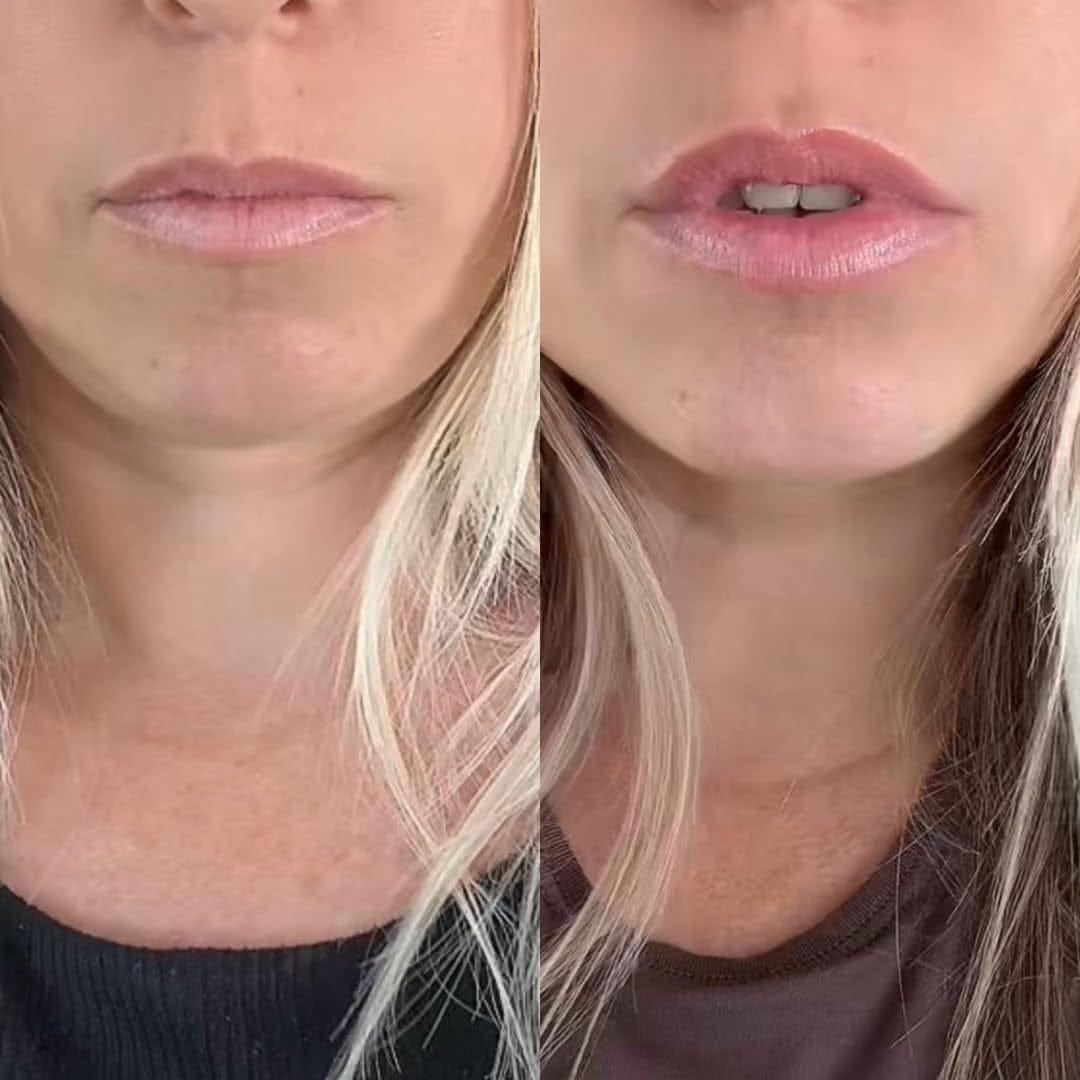 Customer photo review of Dr. Melaxin Lip Shot – гланц за устни с plump ефект