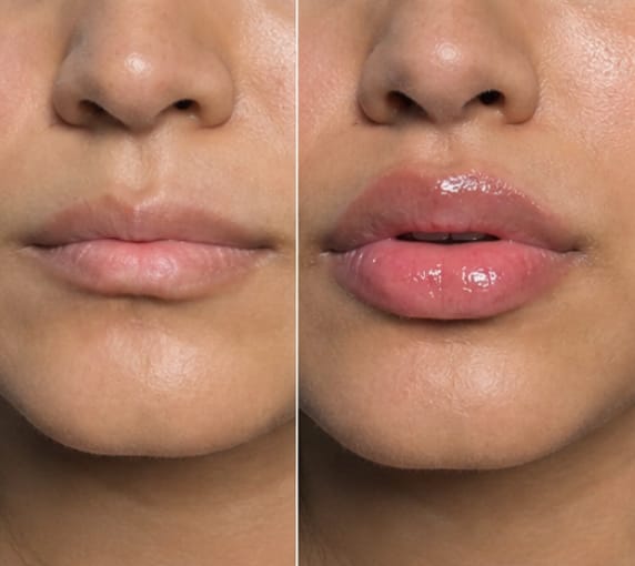 Customer photo review of Collagen Lip Plumper | 100% Natural & Vegan
