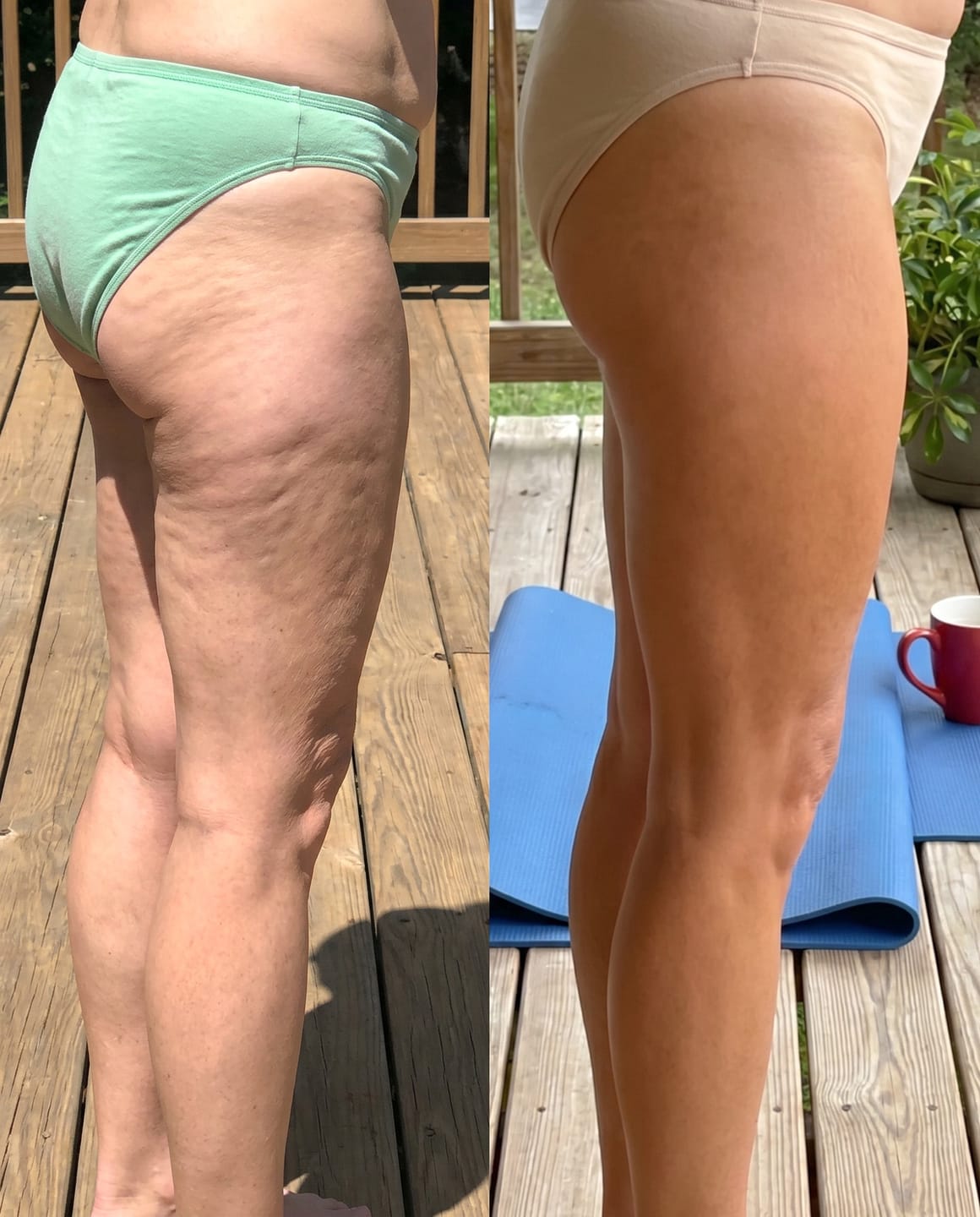 Customer photo review of Goda® Silk Body Oil