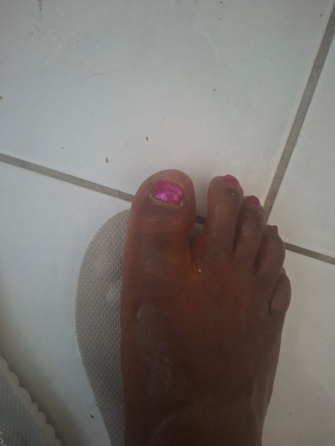 Customer photo review of Foamr® - Massage Einlegesohlen