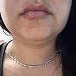 Customer photo review of Dr. Melaxin Lip Shot – гланц за устни с plump ефект