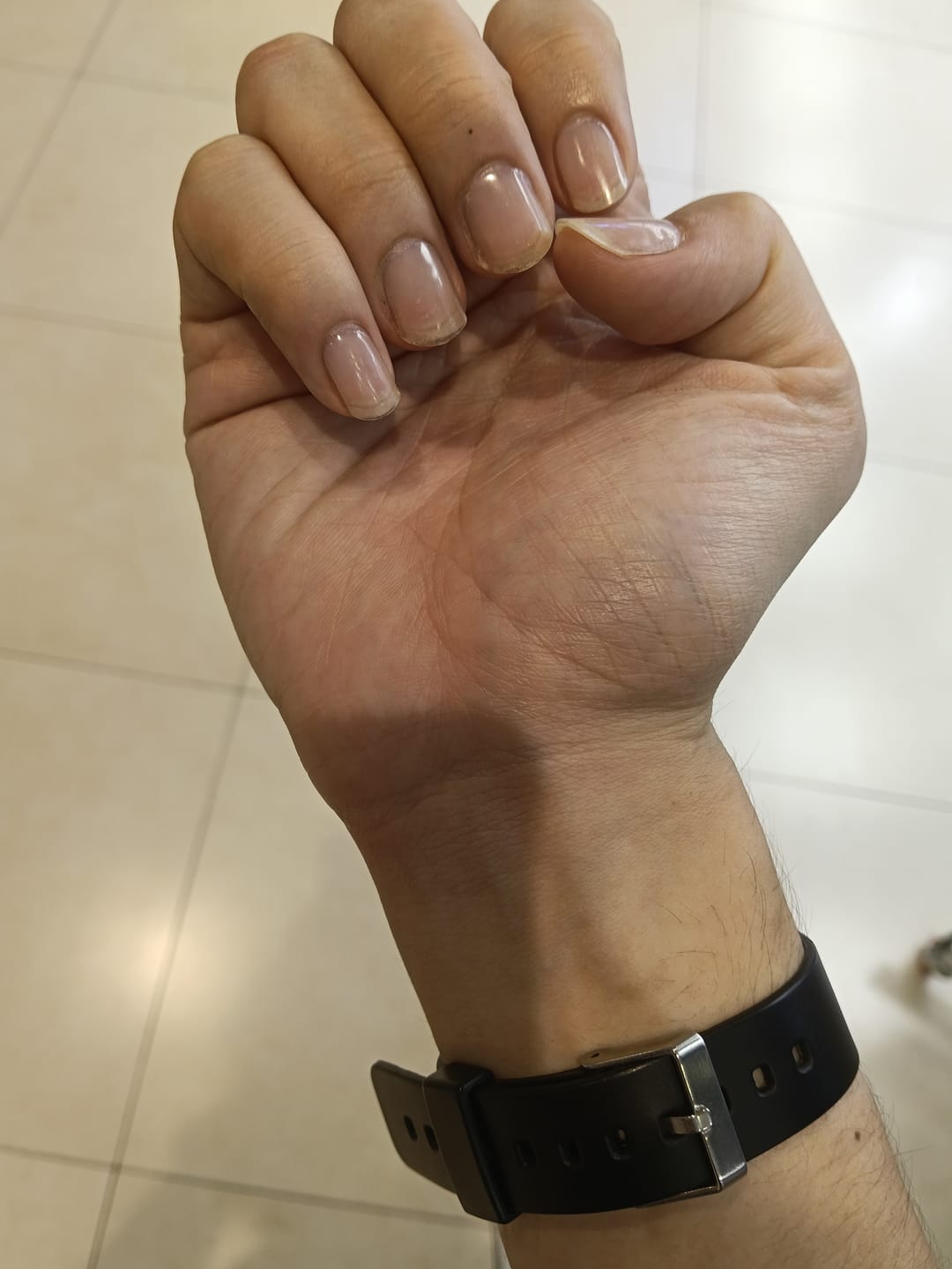 Customer photo review of Crystal Clear DIY Semicured Gel Nail Sticker Kit (STOP NAIL BITING & GROW BRITTLE NAILS)