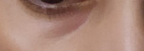 Close-up of a reviewer's eye, showing the under-eye area and dark circles after using the Bakuchi Peptide Eye Crème.
