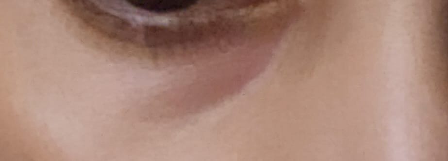 Customer photo review of Bakuchi Peptide Eye Crème