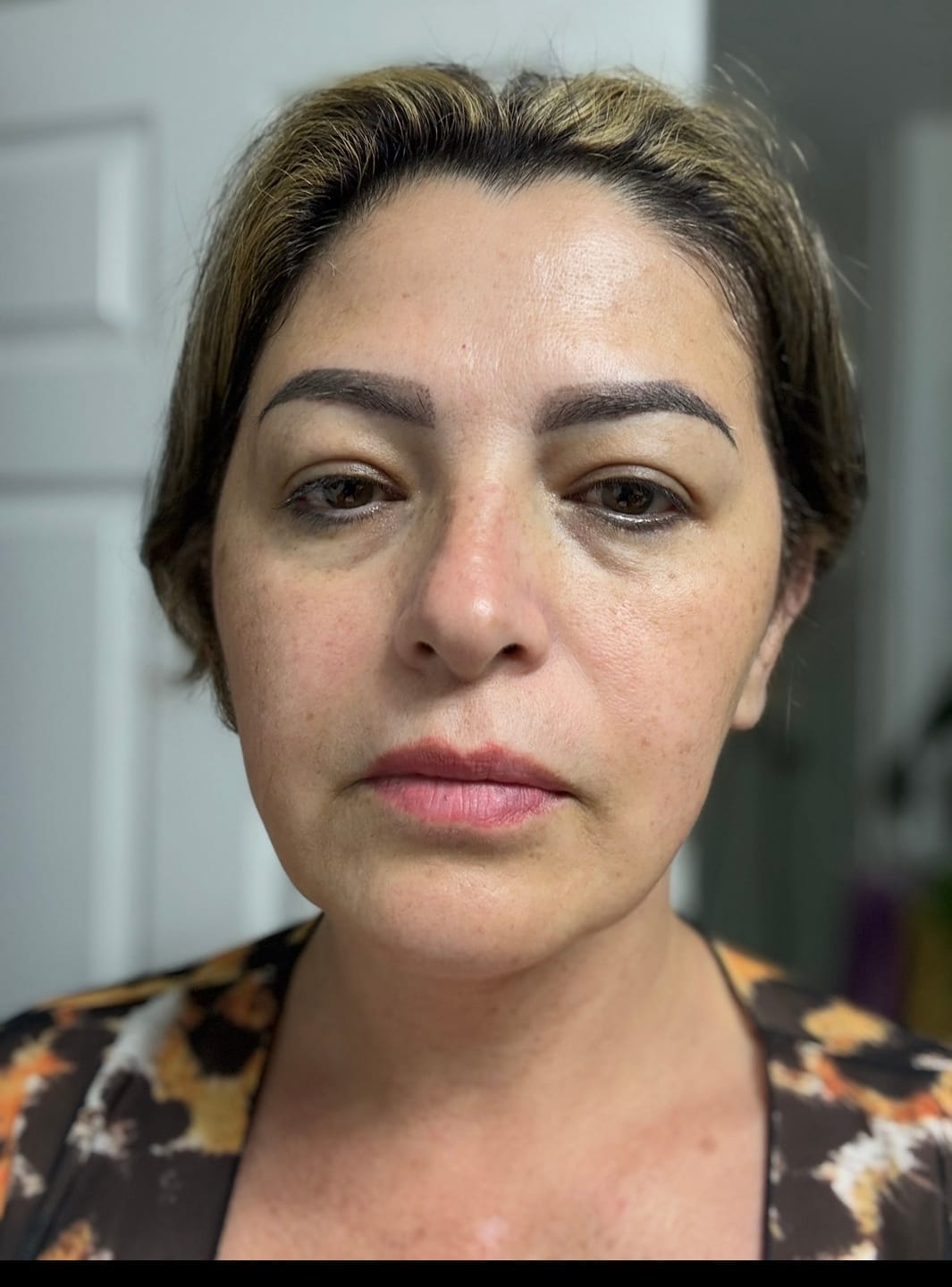 Customer photo review of INIA GLOW Neck & Chest Red Light Therapy