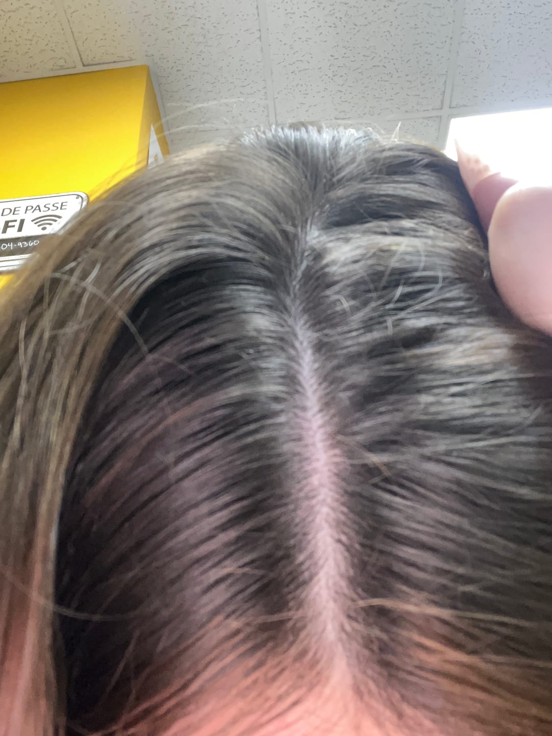 Customer photo review of Pre-Wash Fortifying Rosemary Oil for Scalp