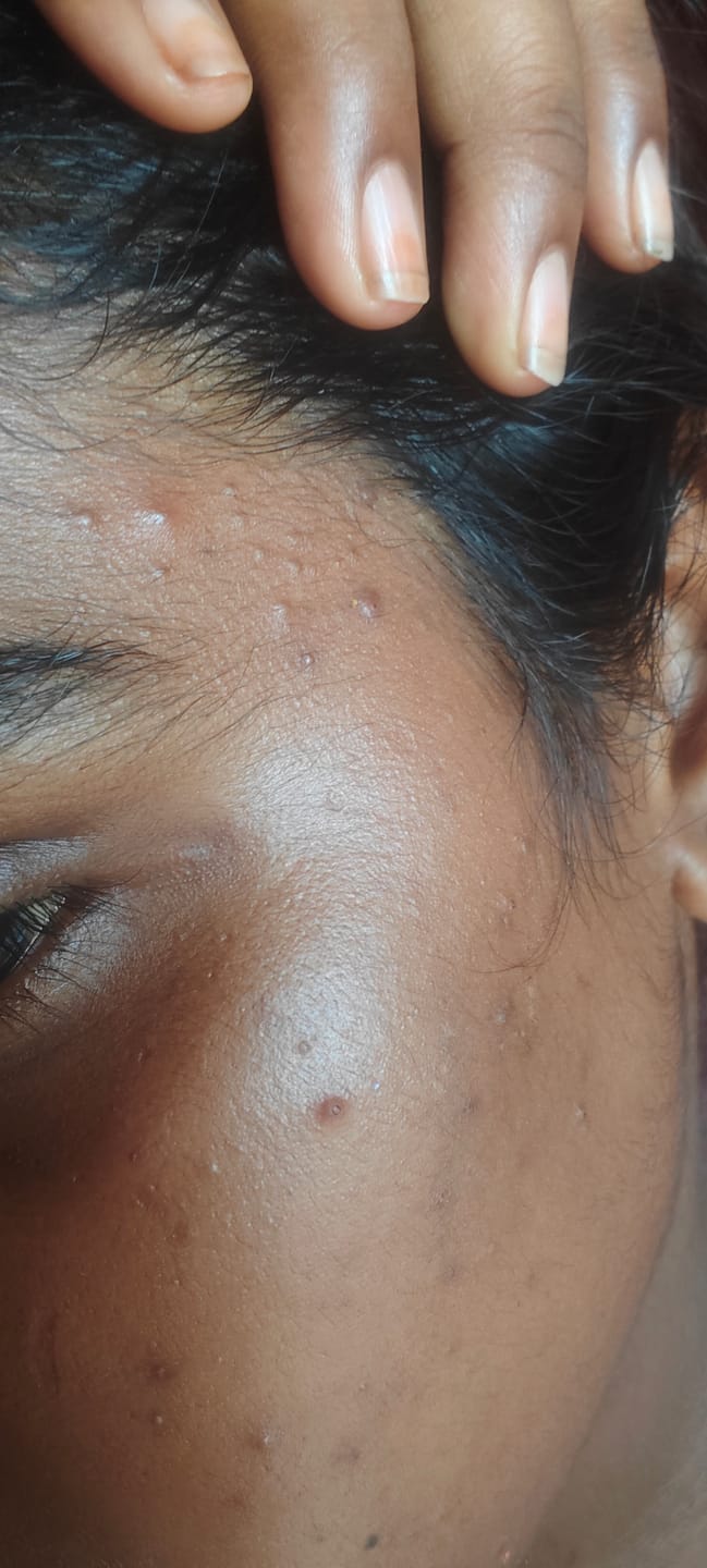 Customer photo review of Turmeric Night Repair Cream