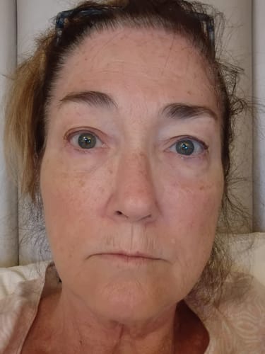Reviewer's close-up showing skin texture and fine lines in a review for the Deep Collagen Cream.