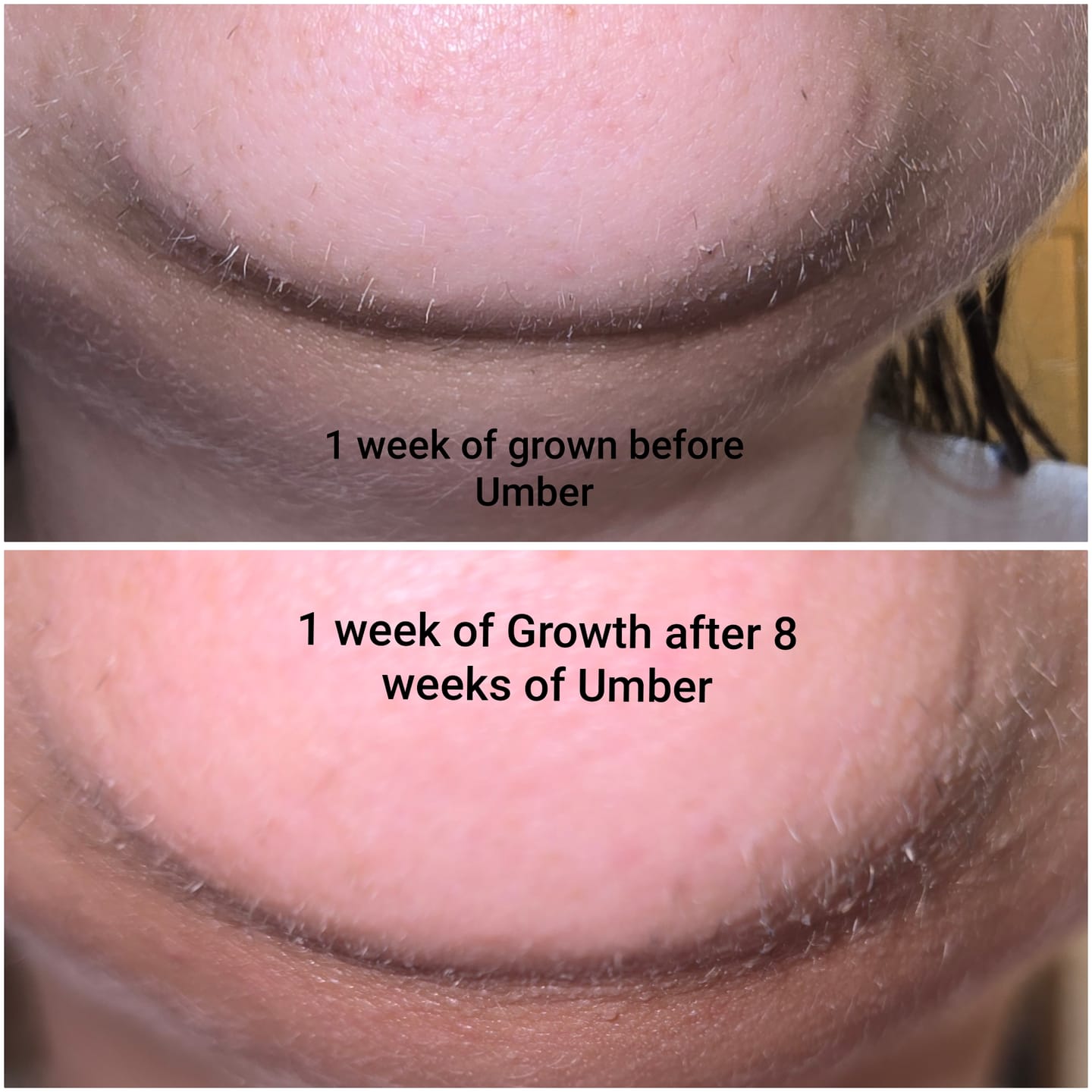 Customer photo review of Hair Reducing Fade Oil - Slows Growth, Thins, and Reduces Hair Naturally